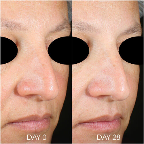 RHA®️ Hydra Mask